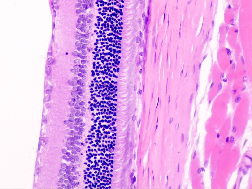 1-RetinaHEstain