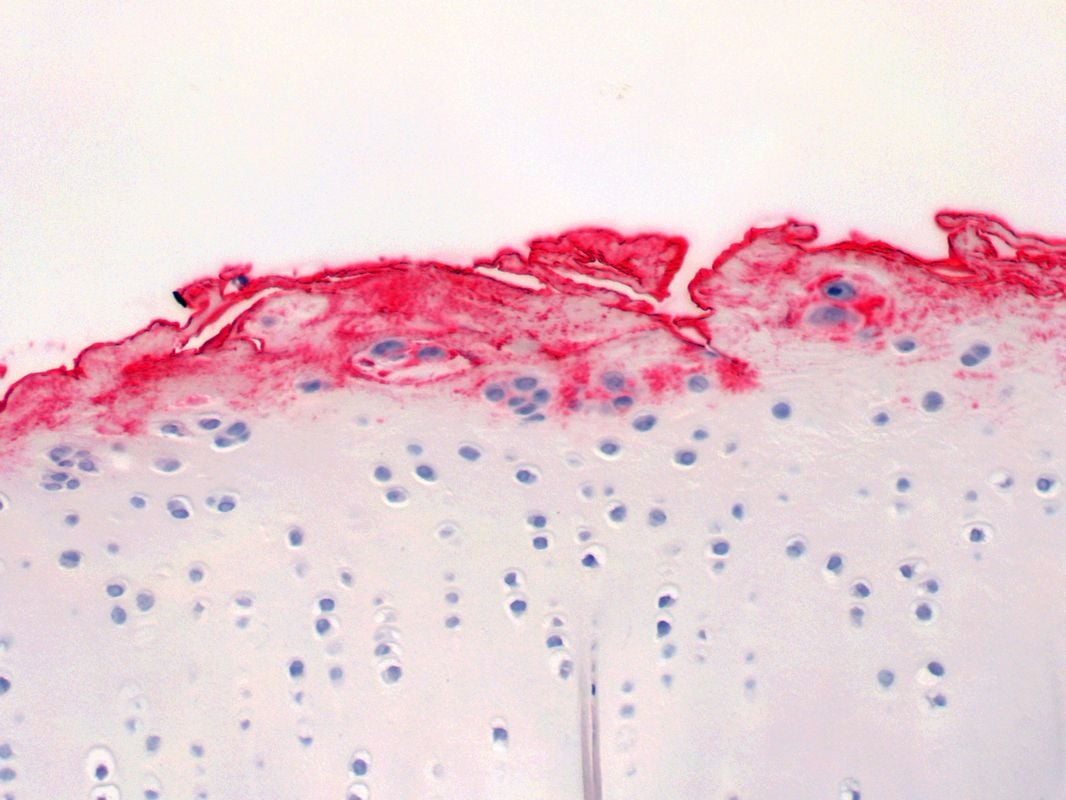 Cartilage Lubricin IHC label