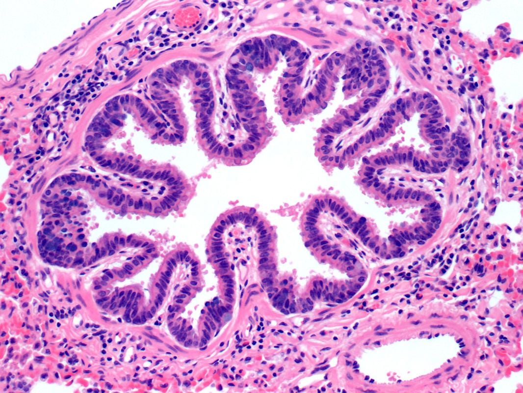 18-Bronchus