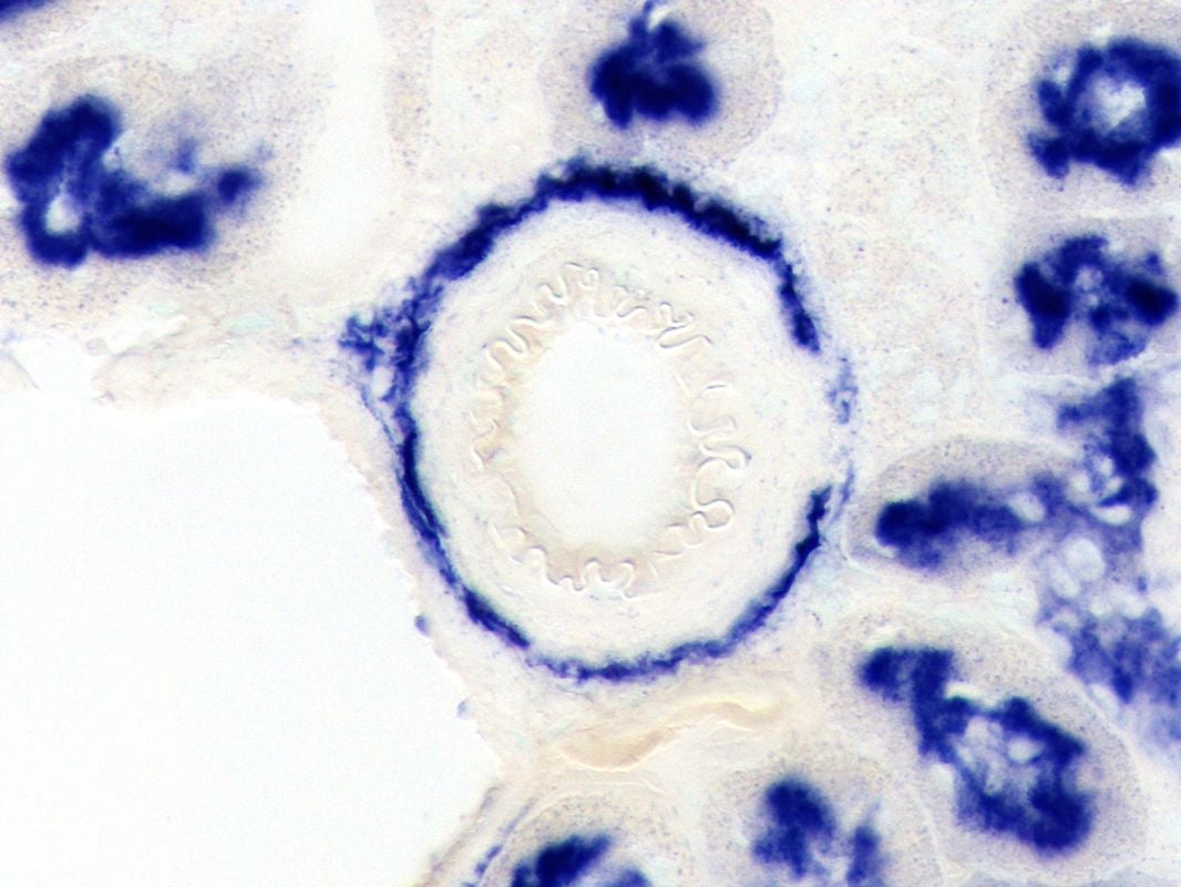 26-Kidney