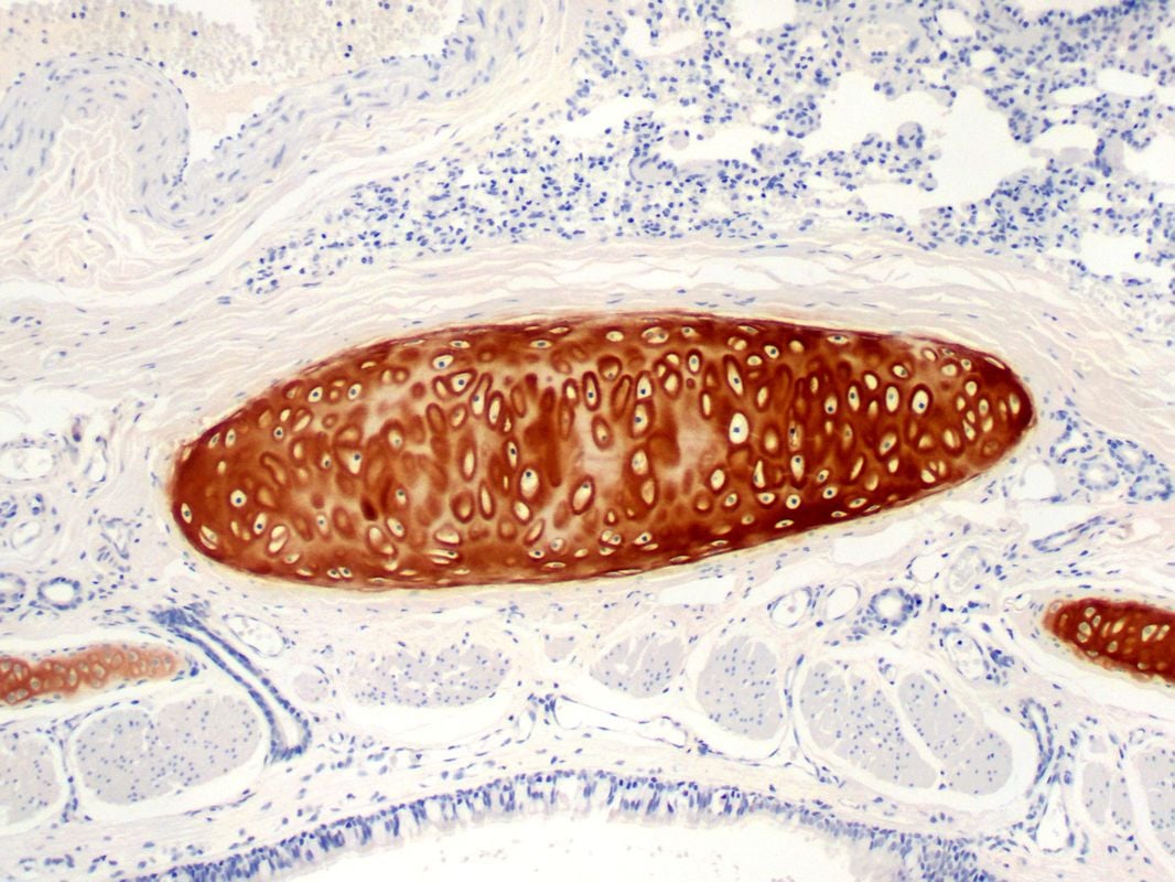 7-TracheaType-II