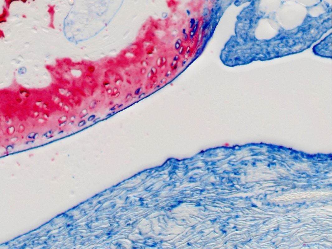 9-Cartilagesynovium