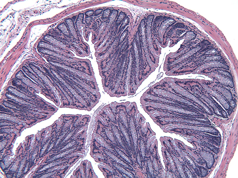 ACD7MAUC-Normal-Distal-Colon