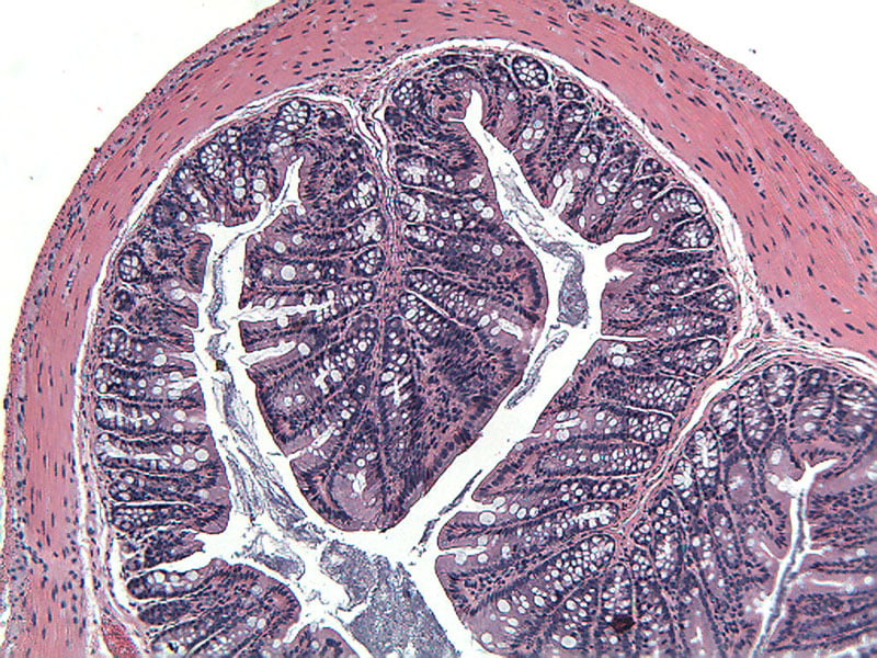 ACD8MAUC-Normal-Proximal-Colon