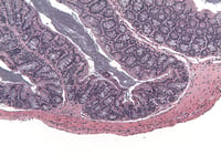 ATC-5MCD4-Normal-Proximal