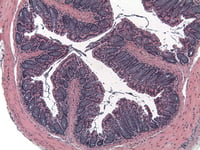 ATC-6MCD4-Normal-Distal-1