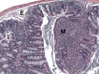 ATC-7MCD4-Diseased-Proximal