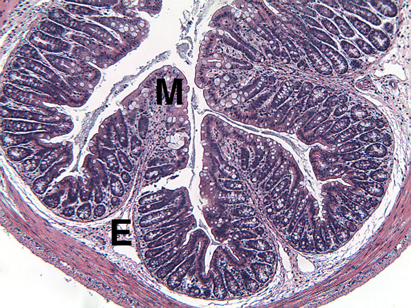 DSI2MDSS-Diseased-Proximal