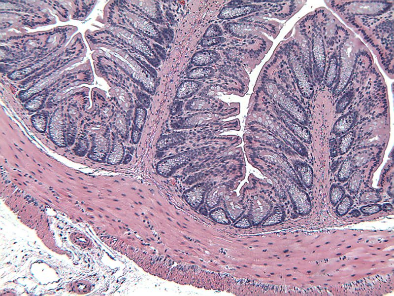 DSI3MDSS-Normal-Distal