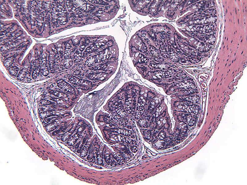 DSI4MDSS-Normal-Proximal