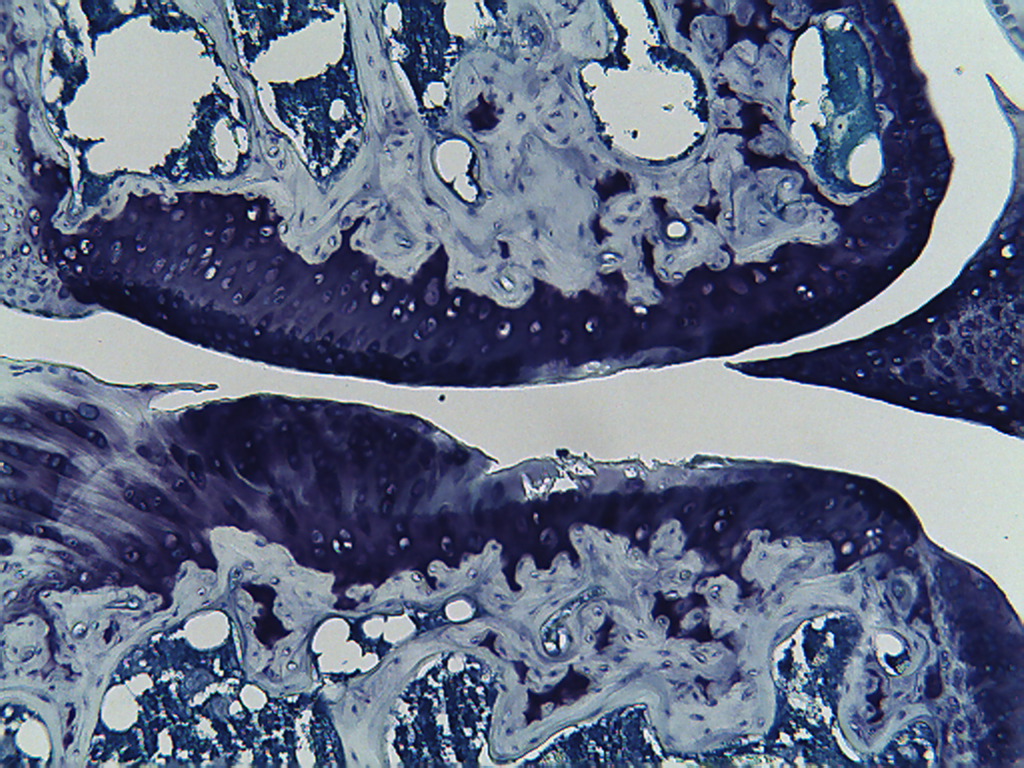 Grp11-An10-Level-3-Knee-100x