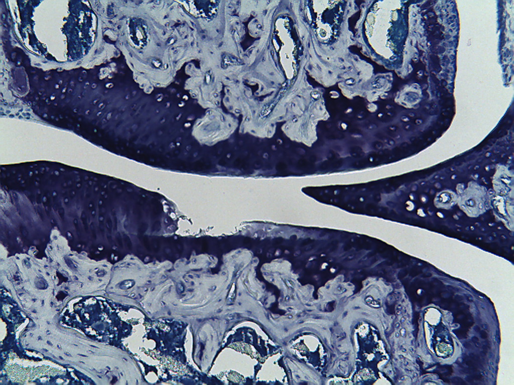 Grp12-An20-Level-2-Knee-100x