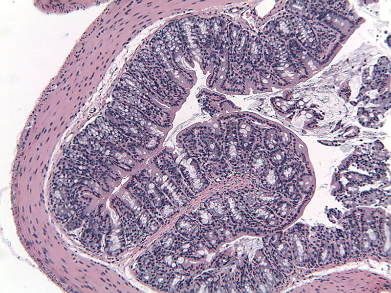 MTNBS1-Normal-Middle-Colon-100x