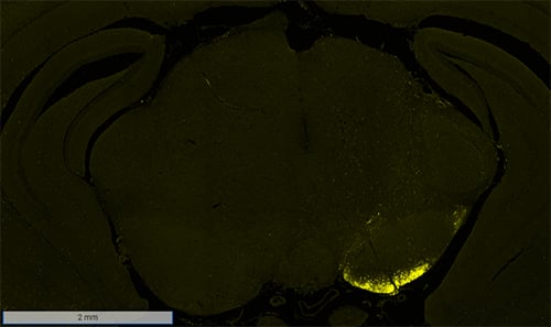 Expression of phospho-a-synuclein