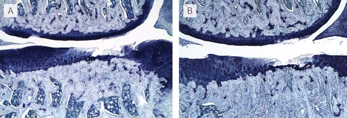 Osteoarthritis-photomicrographs-of-knee-joint-sections-2