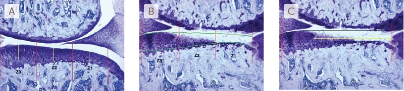 Osteoarthritis-photomicrographs-of-knee-joint-sections