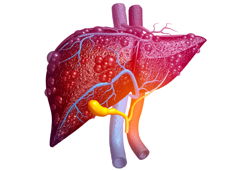 Diabetic and Metabolic research solutions