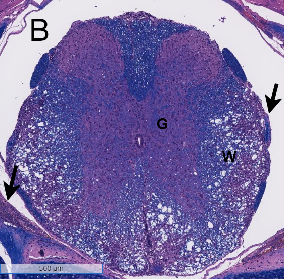 Spinal-Cord_EAE-model