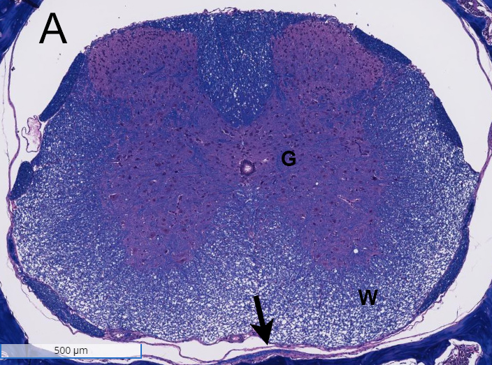 Spinal-Cord_Nondisease-Control