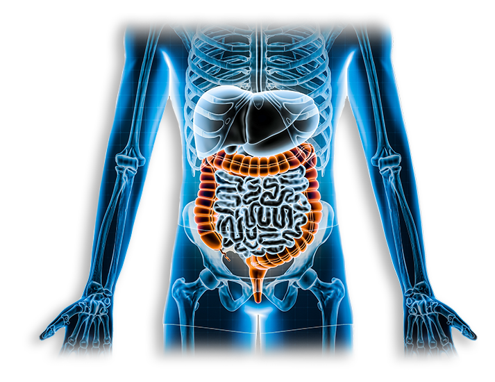 Inflammatory Bowel Disease