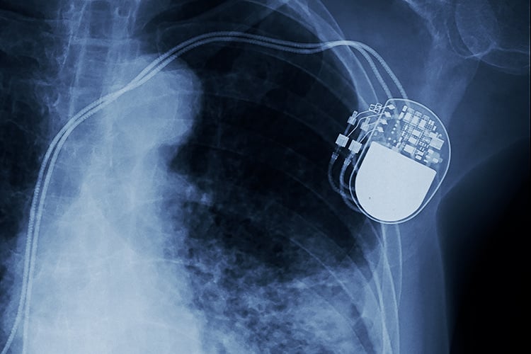 Pathology Evaluation of Medical Devices